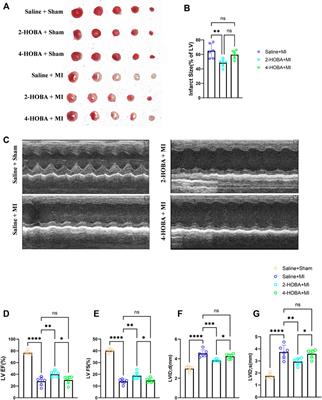 Isolevuglandins Scavenger Ameliorates Myocardial Ischemic Injury by Suppressing Oxidative Stress, Apoptosis, and Inflammation